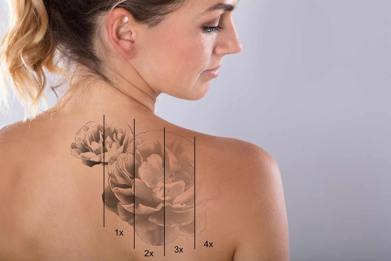 ¿Cuáles son los riesgos de borrar un tatuaje con láser?