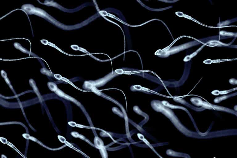 Necrozoospermia: causas de la muerte de los espermatozoides