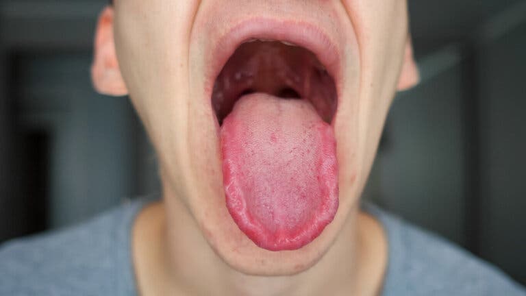 ¿Lengua adormecida? Mira estas 18 posibles causas
