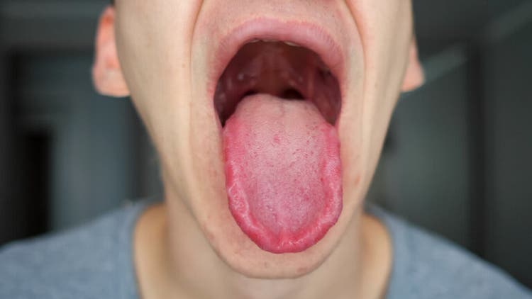 ¿Lengua adormecida? Mira estas 18 posibles causas - Mejor con Salud