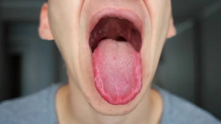 ¿Lengua adormecida? Mira estas 18 posibles causas