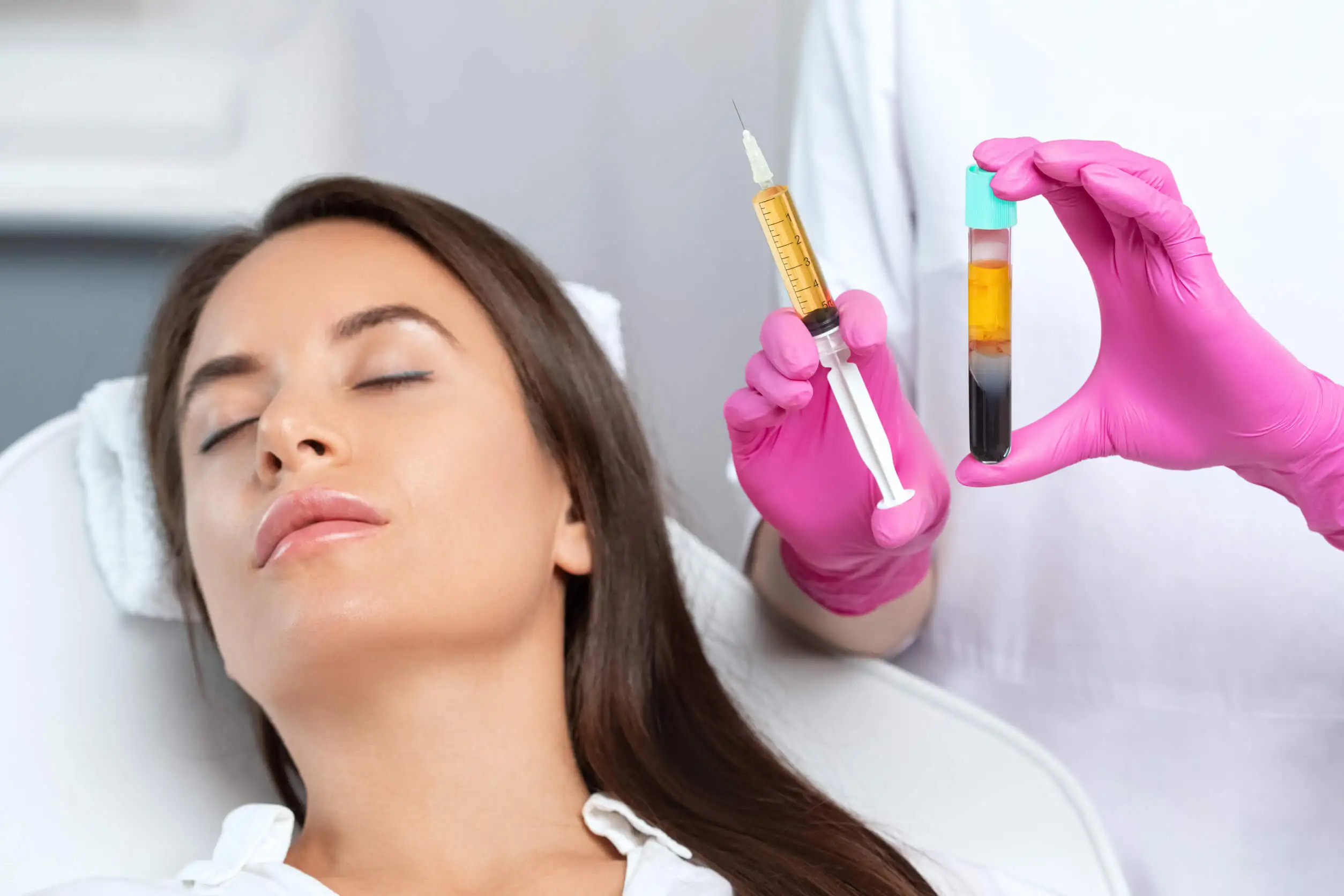 Plasma rico en factores de crecimiento para tratamientos de belleza.