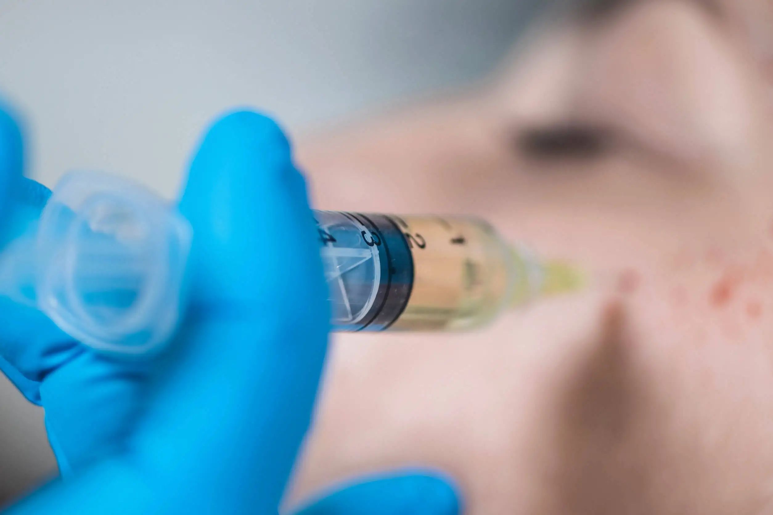 Hair Biostimulation