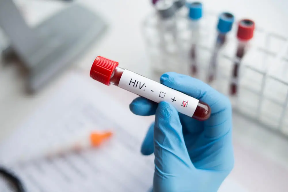 Las situaciones en las que no puedes amamantar incluyen la infección por VIH