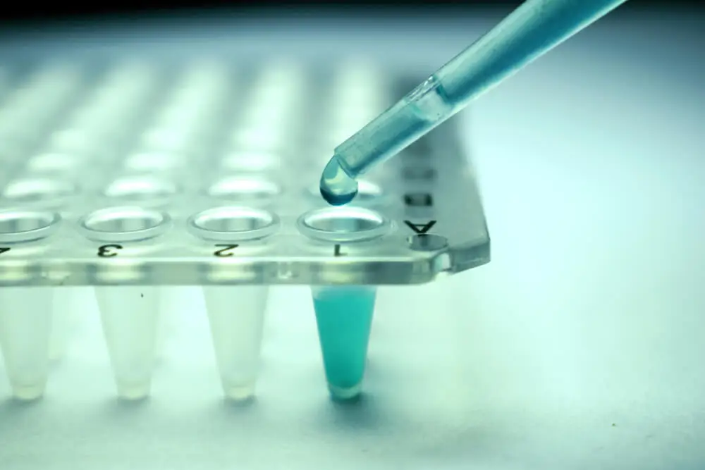 Traitement en laboratoire du VIH.