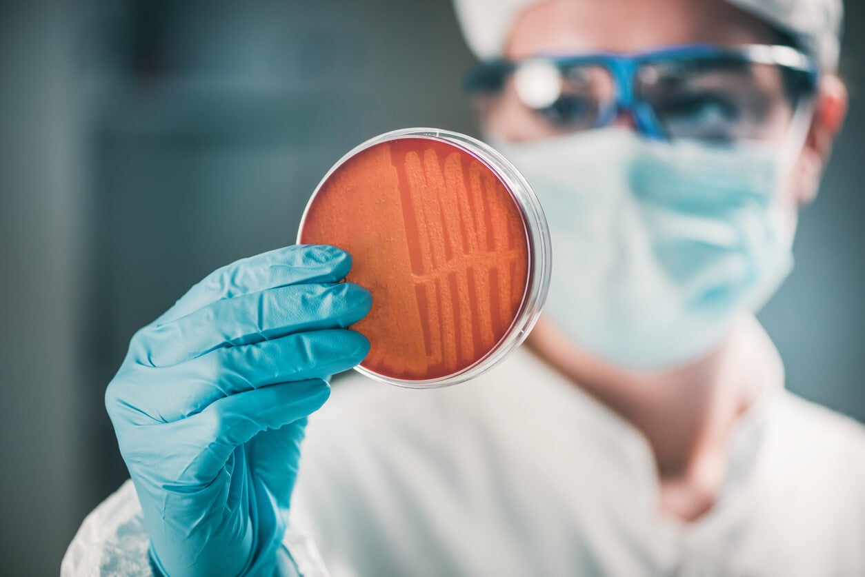 Myrrheöl - Frau mit einer Bakterienkultur in einer Petrischale