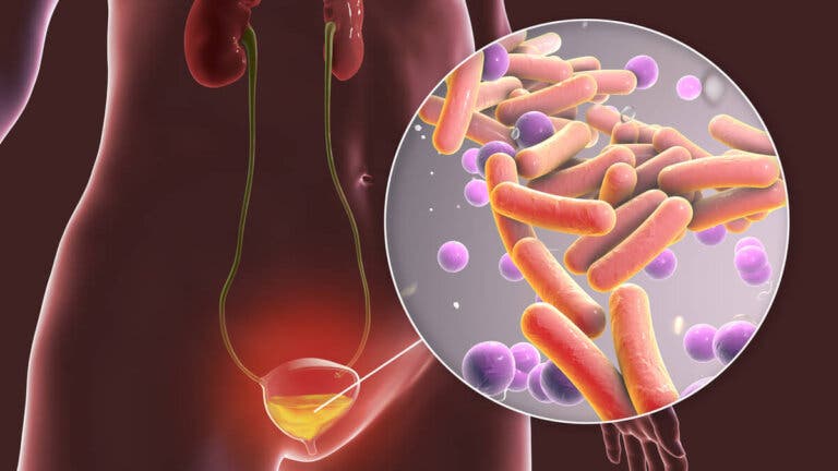 Bacterias en la orina: ¿por qué aparecen y qué tratamientos hay disponibles?