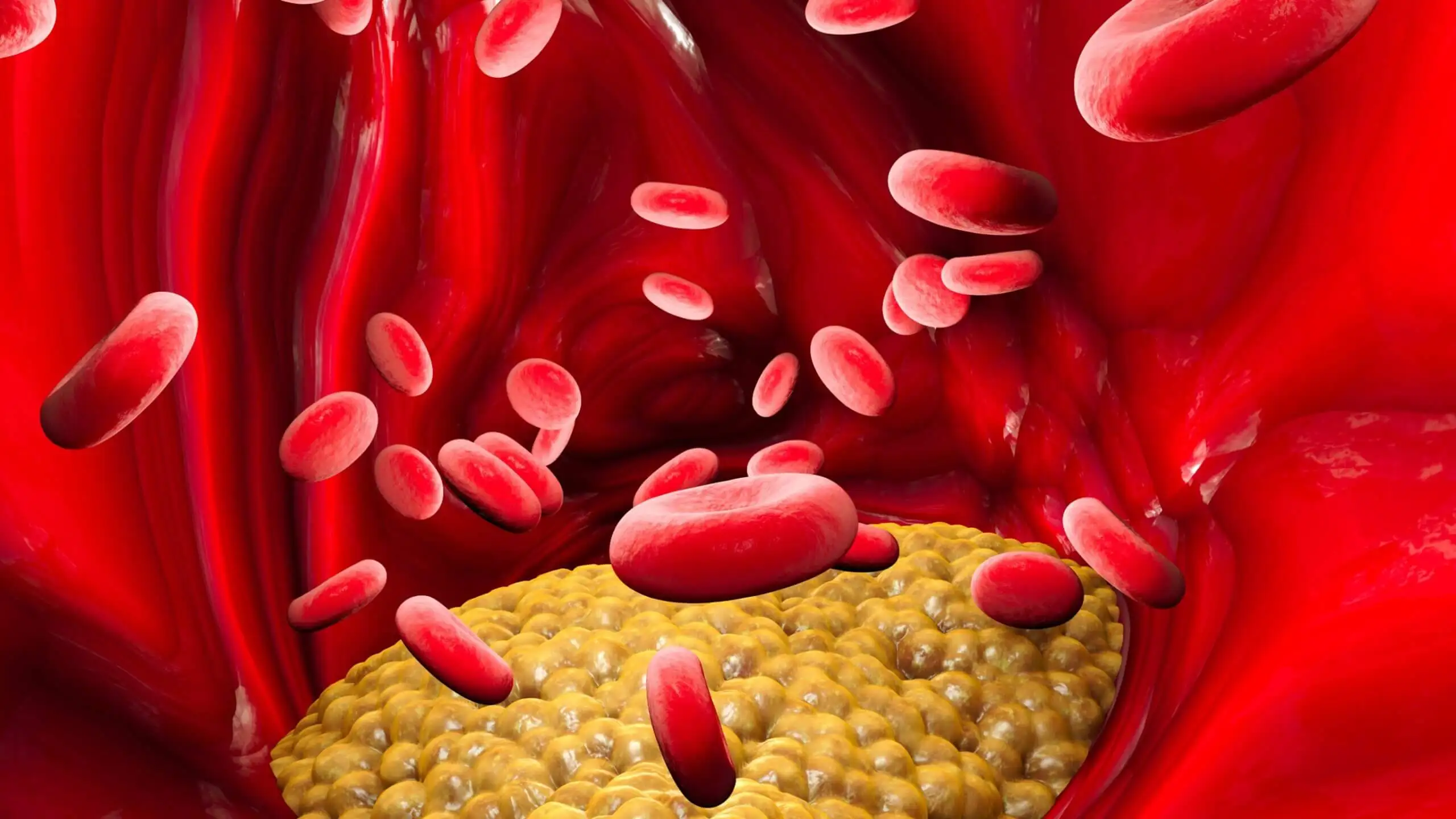 Pimentón de la Vera na cholesterol