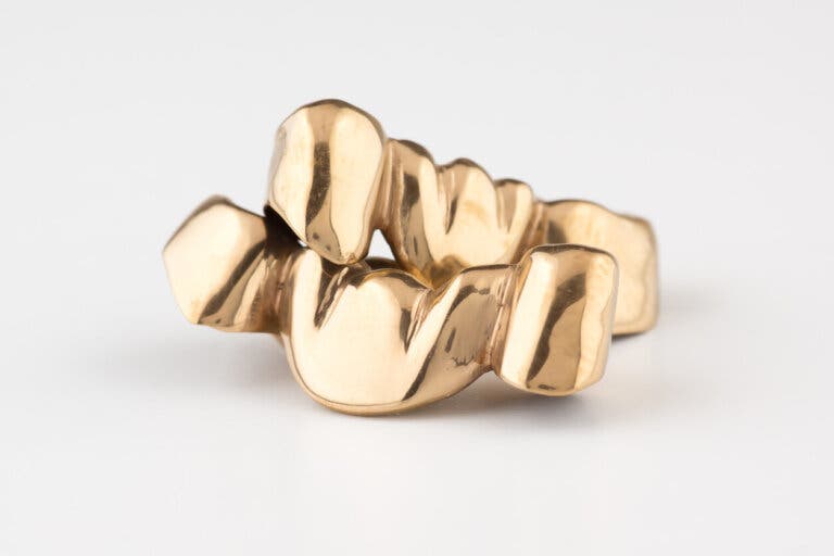 Grillz en los dientes: riesgos y cuidados