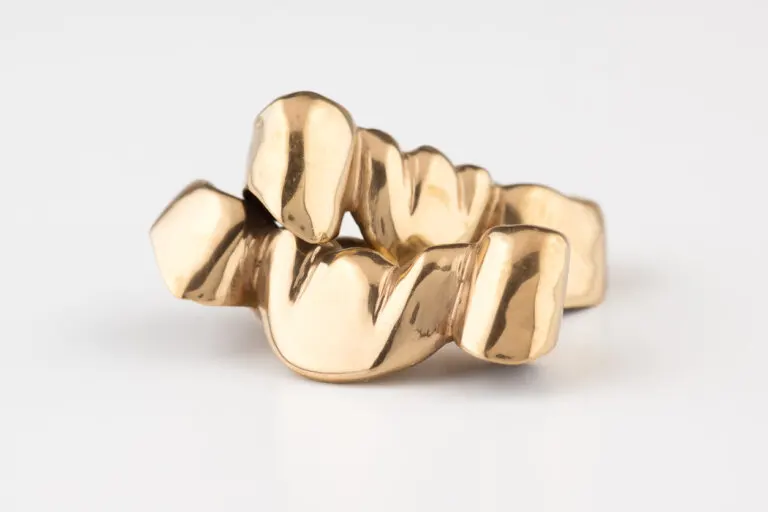 Grillz en los dientes: riesgos y cuidados