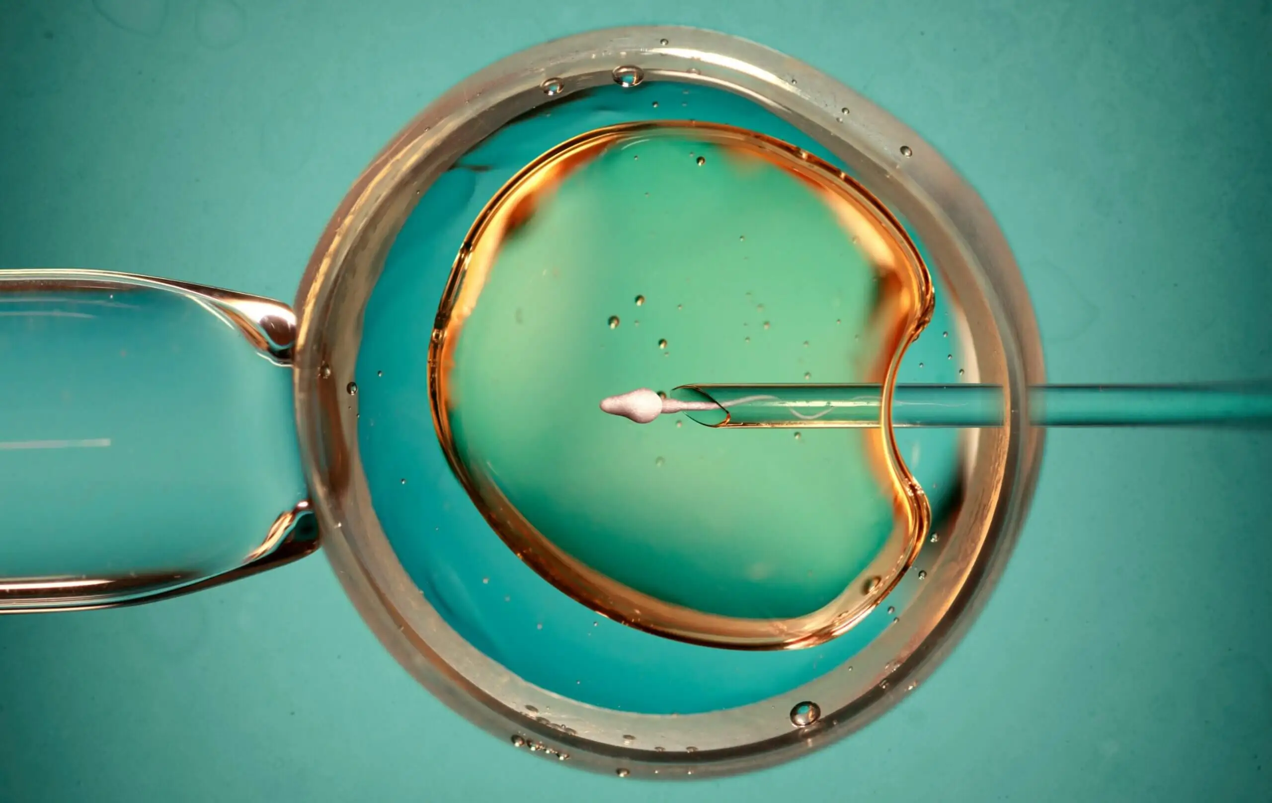 IVF