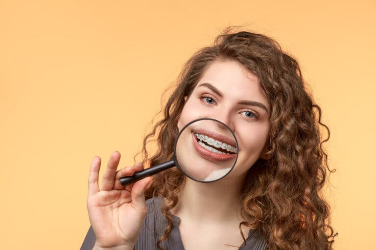 ¿Se pueden blanquear las gomas de los brackets?