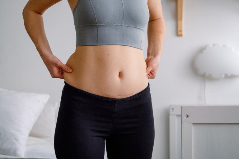 Ejercicio físico tras la cesárea: ¿cuándo empezar?