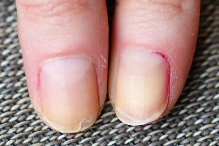 7 señales que te dan las uñas de las manos de que algo va mal en tu salud