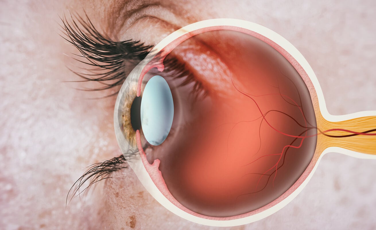 Anatomie de l'oeil avec pli maculaire.