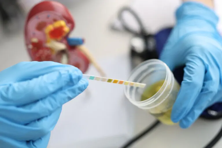 Bacteriuria asintomática: causas comunes y cómo tratarla