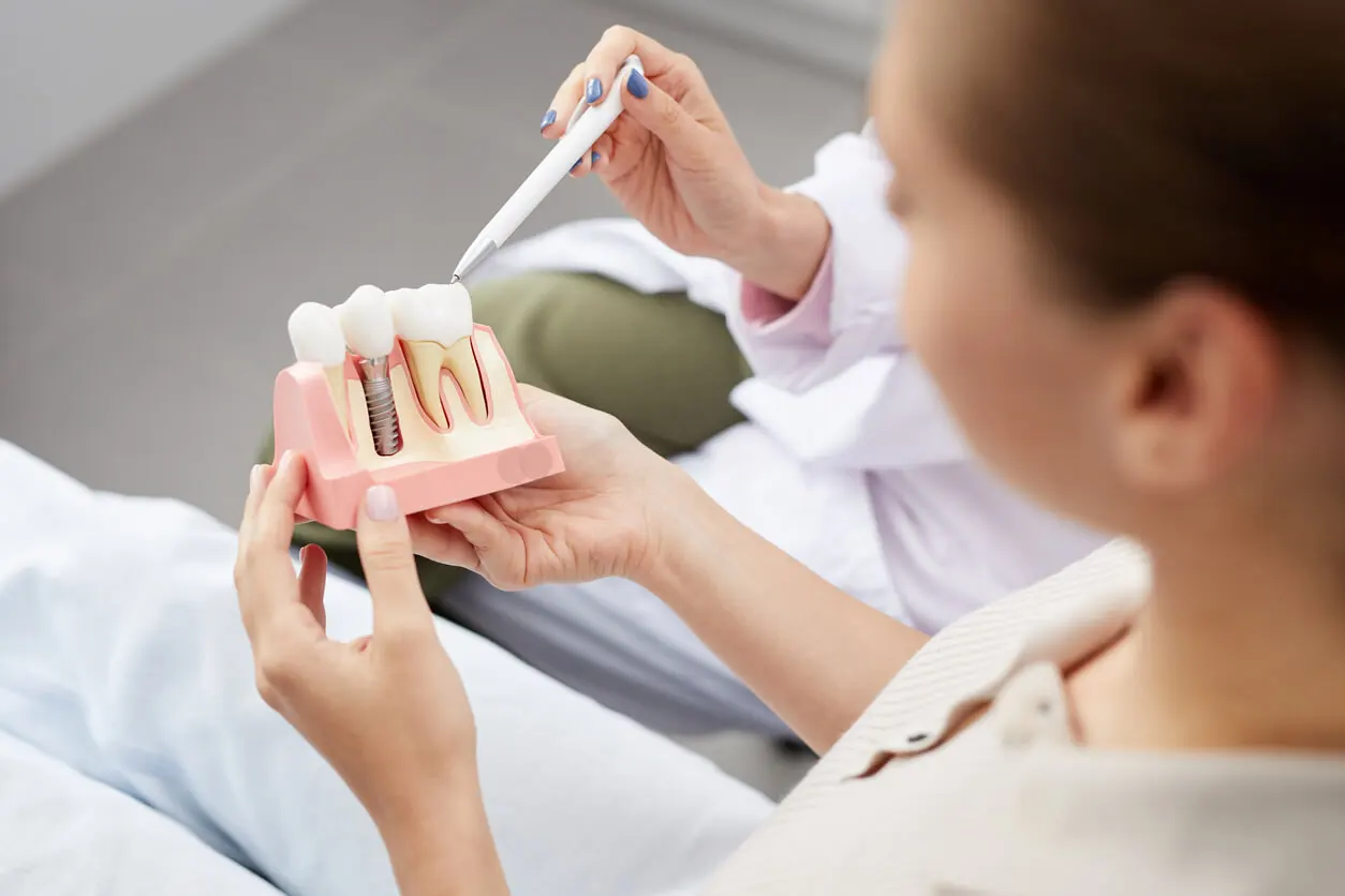oral rehabilitation implants