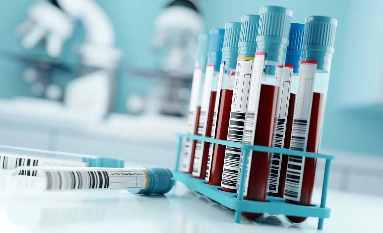 Prueba de proteínas totales: resultados y su significado.