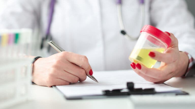 Examen de urea y creatinina en orina: significado de los resultados