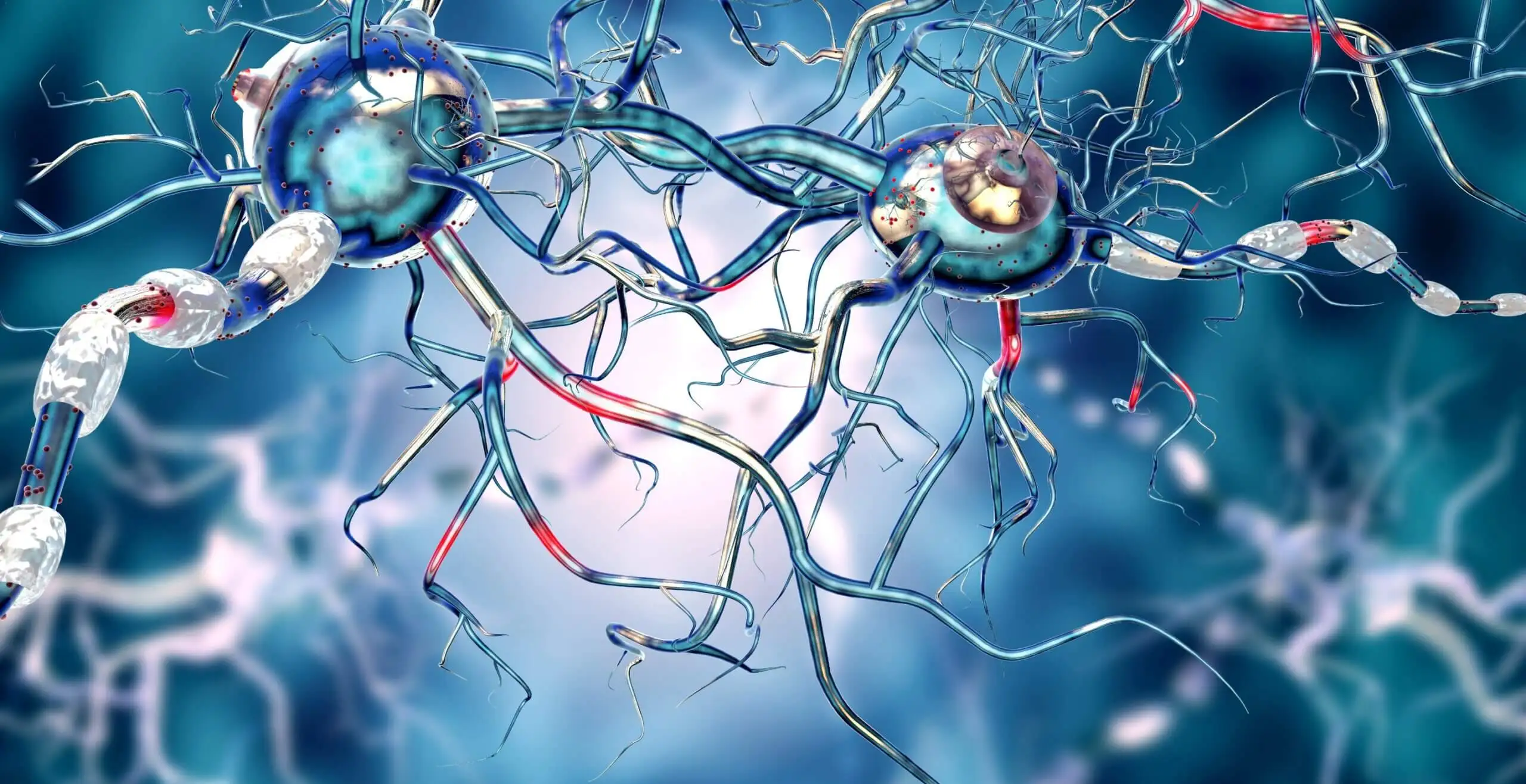 MS in the brain