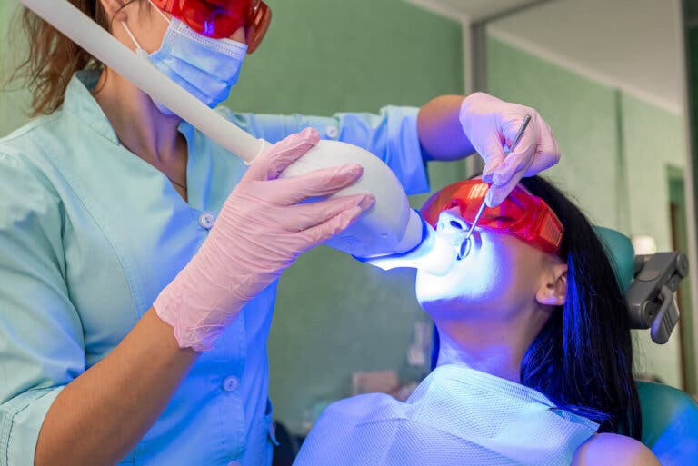 Blanqueamiento dental LED: ventajas, desventajas y cuidados