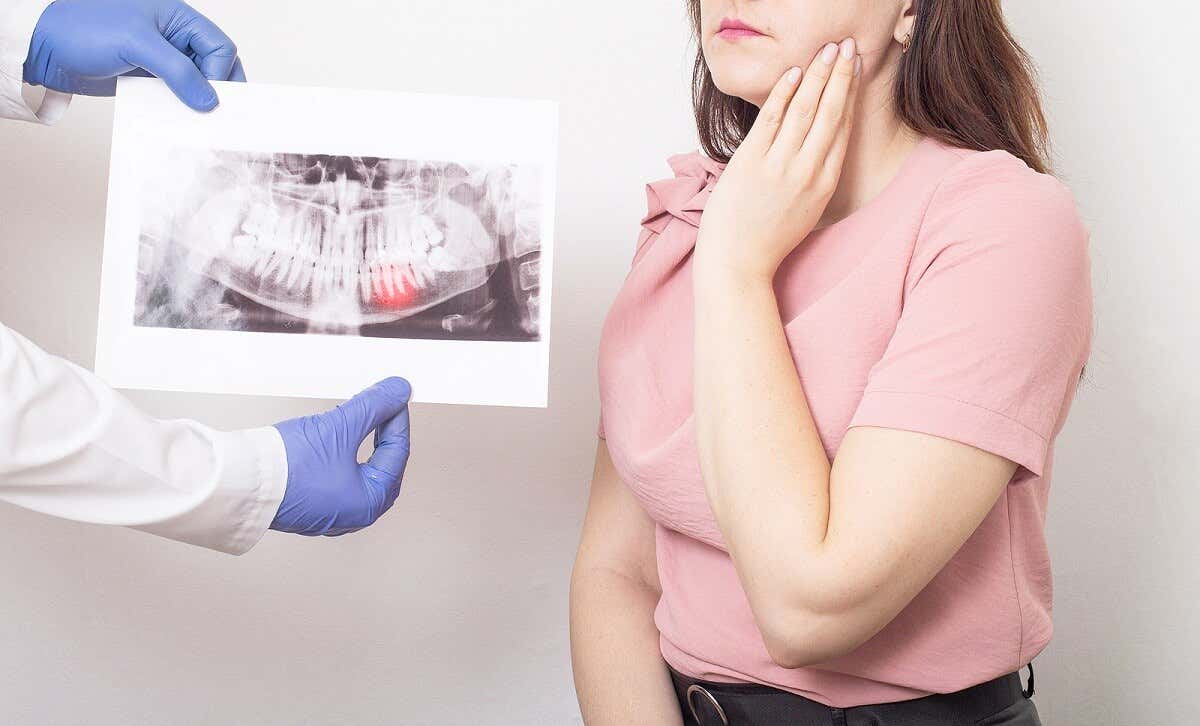 Kvinde med tandpine og billede, der viser tandkødsbetændelse, som har ført til lilla tandkød