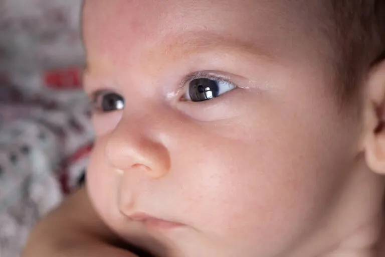 Aniridia o ausencia del iris: ¿qué es y por qué se produce?