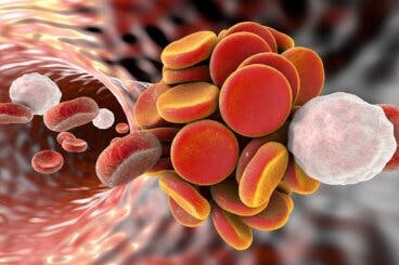 Síndrome antifosfolípido: causas, síntomas y tratamientos