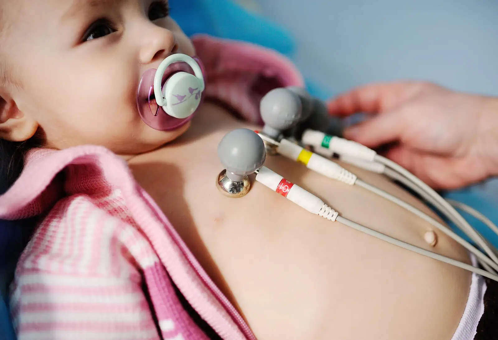 le diagnostic définitif repose sur l'échocardiogramme