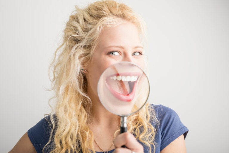 4 tipos de blanqueamiento dental