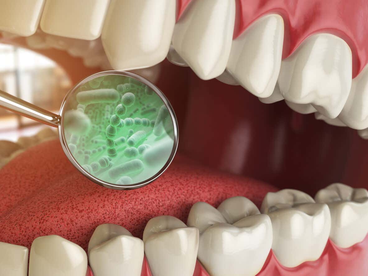 Bakterier i munnen kan forårsake tykktarmskreft