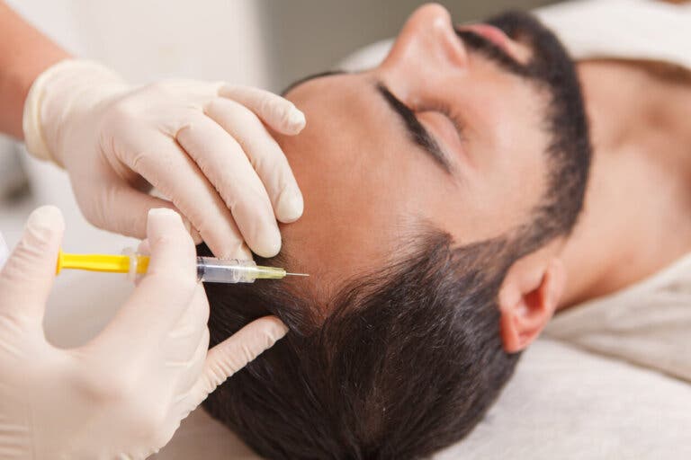 ¿Qué es la bioestimulación capilar con plasma rico en plaquetas?