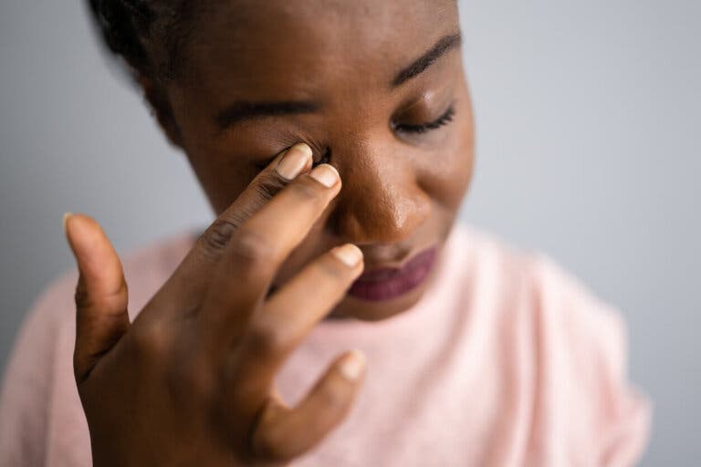 Qué es un pliegue macular: síntomas, causas y tratamientos