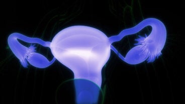 Quistes dermoides ováricos: síntomas y cuándo consultar al médico