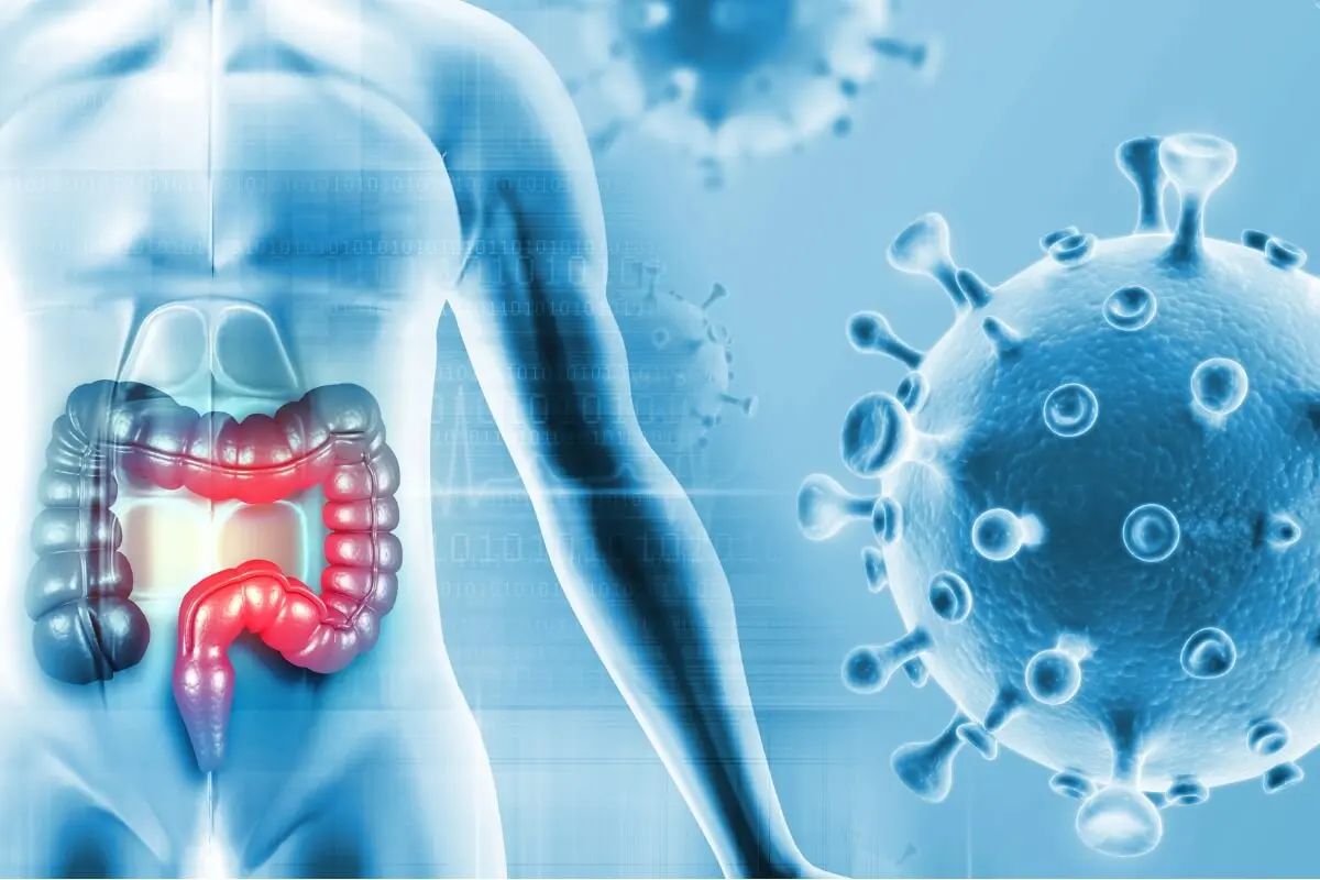 Nuevo estudio identifica una bacteria de la boca que puede promover el cáncer de colon.