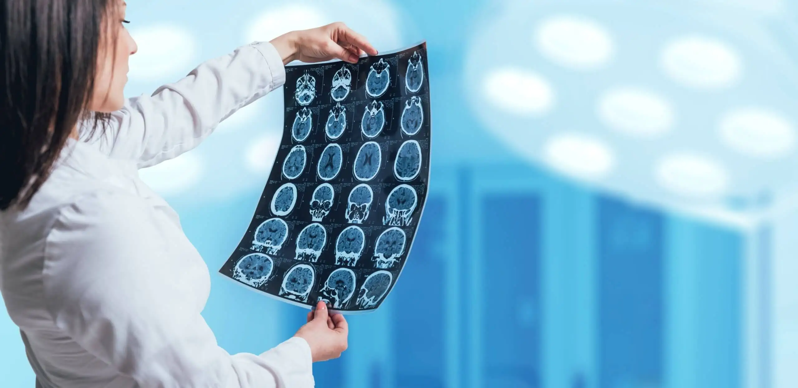 Cerebrale angiografie