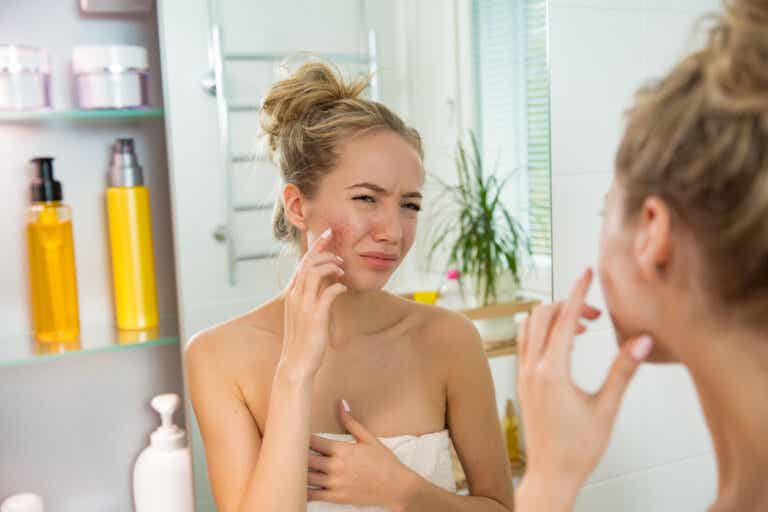 Skin flood o piel inundada: dermatitis por el exceso de cosméticos