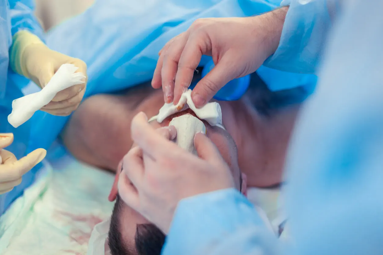 Ultraschall-Rhinoplastik - Bild einer Operation