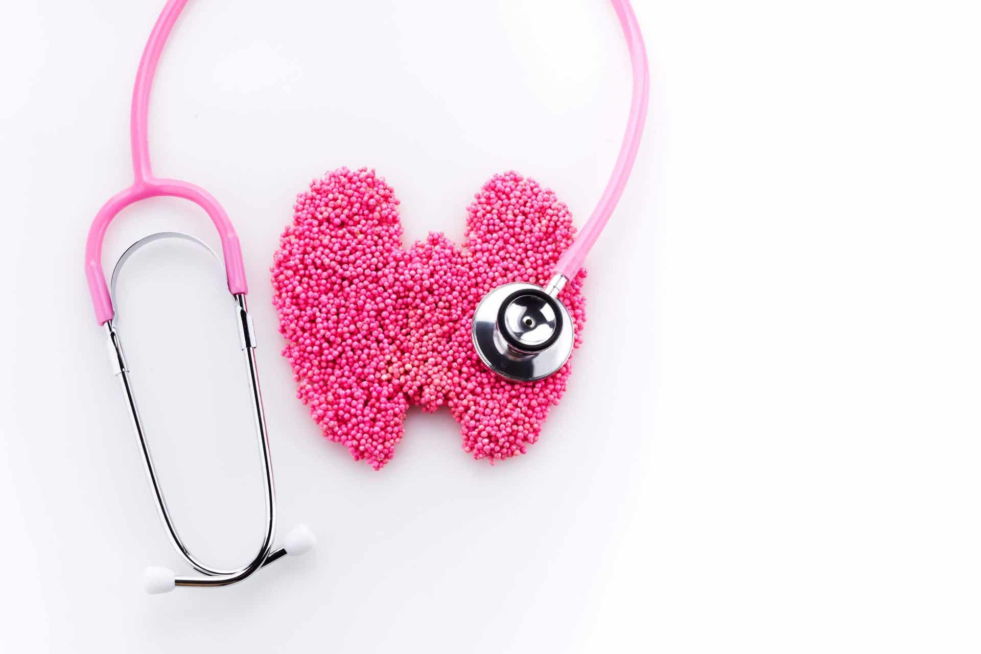 Różowa tarczyca i stetoskop. Rak komórek Hürthle