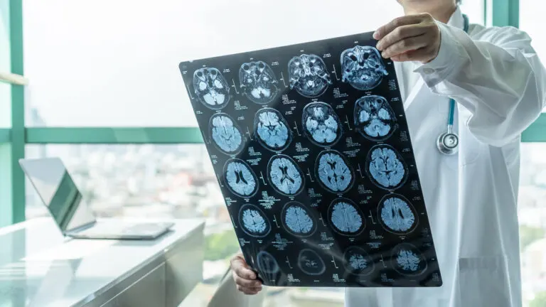 ¿Qué es una unidad de ictus?
