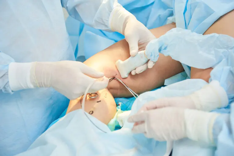 Escleroterapia de las várices: ¿cómo se realiza?
