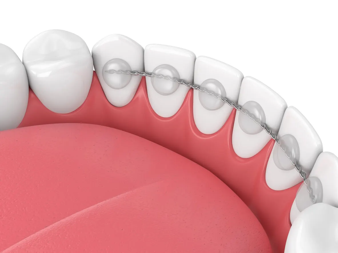 Retainer