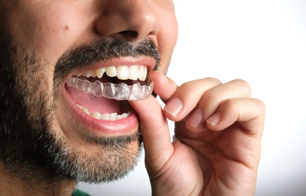 Man haalt een retainer uit zijn mond