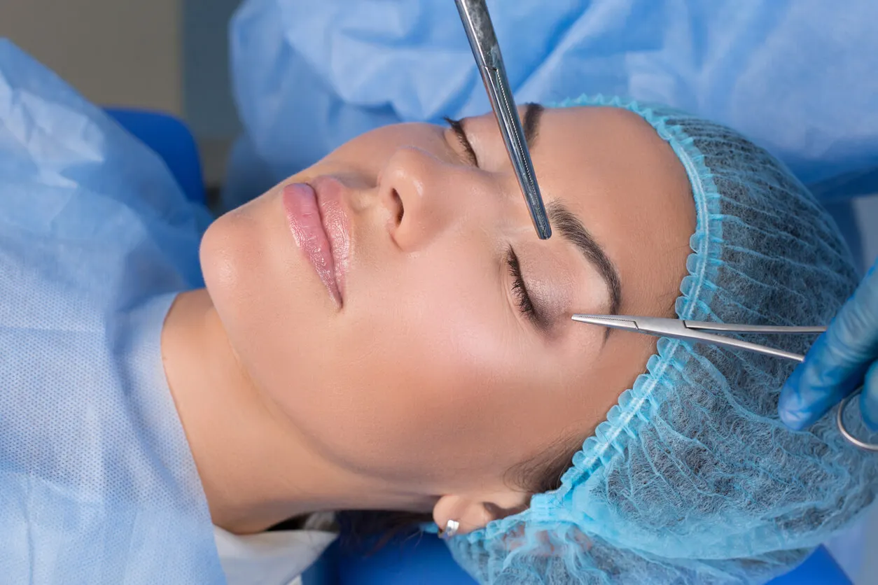 Blepharoplasty.