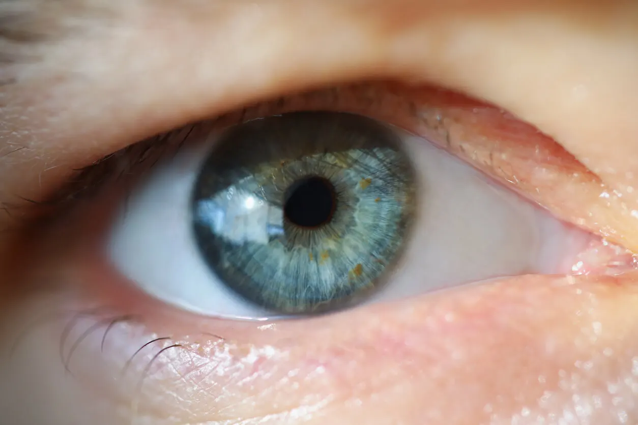 Position of the eyelids.