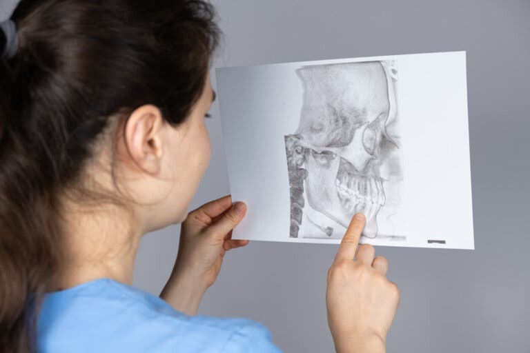 ¿Qué es la retrognatia mandibular y cuál es su tratamiento?