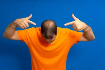 Cuidado del cabello en hombres: guía para prevenir la calvicie