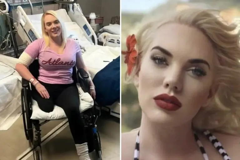La modelo Jennifer Barlow perdió una pierna por una infección conocida como fascitis necrotizante