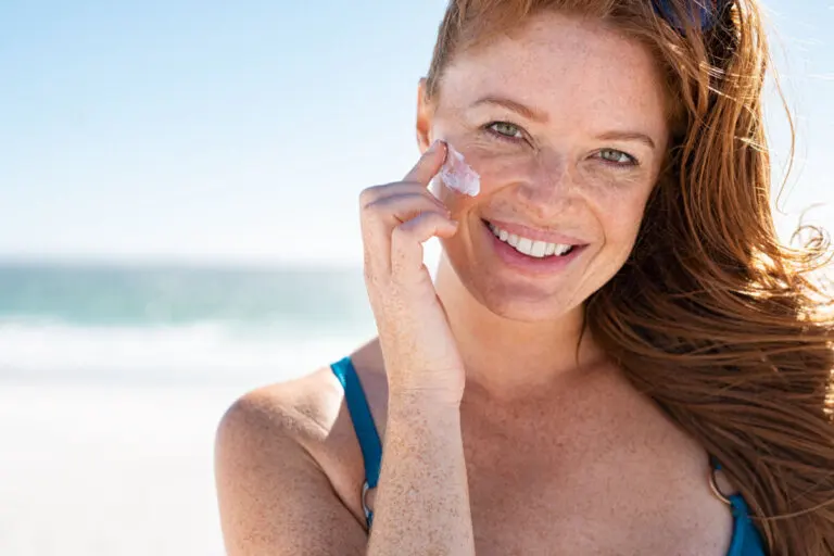 7 consejos para cuidar tu piel con pecas de los rayos del sol