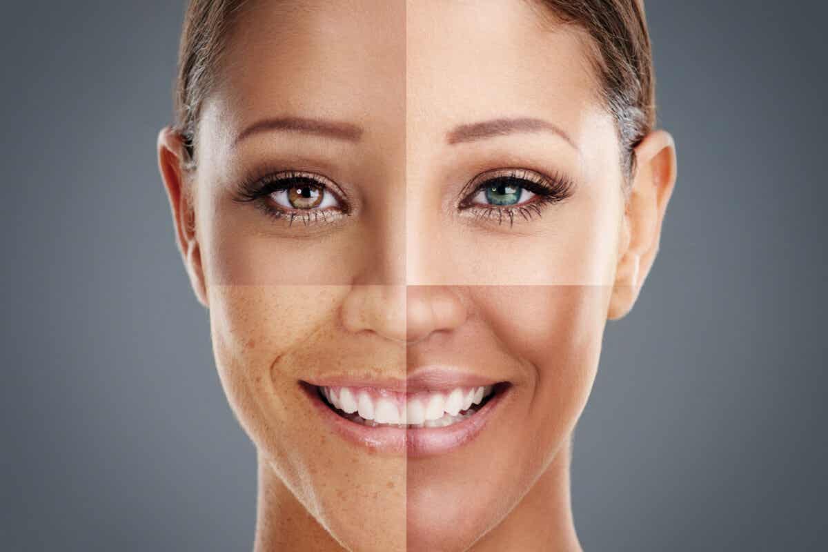 ¿Cómo saber cuál es tu tipo de piel?